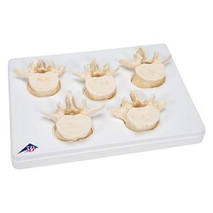 3B Scientific A792 5 Piece Lumbar Vertebrae Set, 11.8" x 8.3" x 2.4"