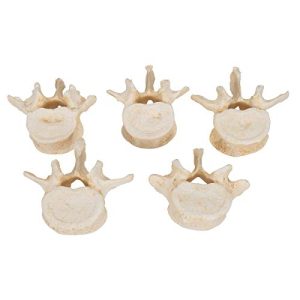 3B Scientific A792 5 Piece Lumbar Vertebrae Set, 11.8" x 8.3" x 2.4"