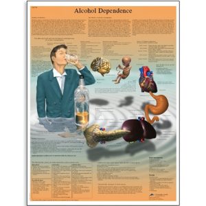 3B Scientific VR1792L Glossy UV Resistant Laminated Paper Alcohol Dependence Anatomical Chart, Poster Size 20" Width x 26" Height