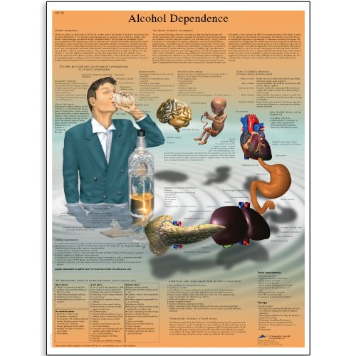 3B Scientific VR1792L Glossy UV Resistant Laminated Paper Alcohol Dependence Anatomical Chart, Poster Size 20" Width x 26" Height
